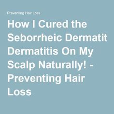 How I Cured the Seborrheic Dermatitis On My Scalp Naturally! - Preventing Hair Loss Prevent Hair Loss, Seborrheic Dermatitis Scalp, How To Treat Acne, Seborrheic Dermatitis Cure