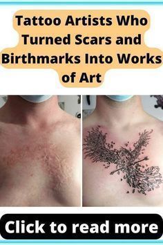 two pictures with the words tattoo artists who turned scars and birthmarks into works of art