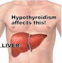 Another reason to shun T4 meds---your liver - Stop The Thyroid Madness Coronary Heart Disease