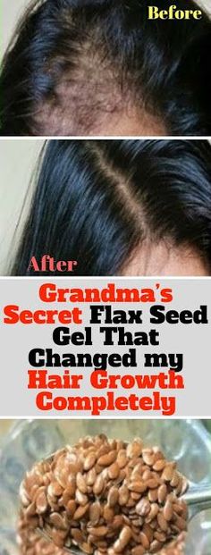 Grandma’s Secret Flax Seed Gel That Changed my Hair Growth Completely #HairGrowth Detox, Boost Hair Growth, Hair Growth Foods, Argan Oil For Hair Loss, Oil For Hair Loss, Healthy Hair Growth, Hydrate Hair, Hair Loss Shampoo