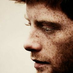 a man with freckles on his face looking to the side