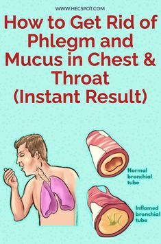 Getting Rid Of Phlegm, Getting Rid Of Mucus, Mucus In Throat, Chest Congestion Remedies, Pain Remedies, Chest Congestion, Back Pain Remedies, Sinus Congestion Relief