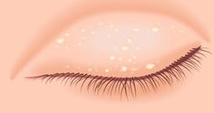 Pimple On Eyelid, Dead Skin Cells, Dermatology, White Bump On Eyelid, Osteoporosis, Eye Health, Chemical Peel, Pimples