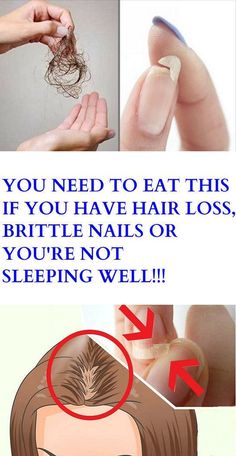 YOU NEED TO EAT THIS IF YOU HAVE HAIR LOSS, BRITTLE NAILS OR YOU’RE NOT SLEEPING WELL! – Stay Healthy Magazine Fitness, Hair Loss, Brittle Nails, Prevent Hair Loss, Hair Loss Remedies, Hair Health, Natural Health