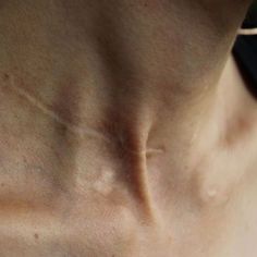 the back of a man's chest with wrinkles and spots on his skin