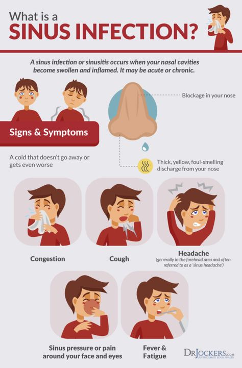 Top 8 Sinus Infection Natural Remedies - DrJockers.com Yoga, Sinus Infection Relief, Sinus Infection, Sinus Remedies, Sinus Congestion, Sinus Headache, Allergic Rhinitis, Sinusitis, Sinus Pain