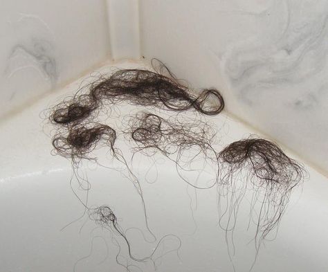 Hair Loss Hair Loss, Hair Growth, Excessive Hair Loss, Hair Loss Remedies, Boost Hair Growth, Home Remedies For Hair, Beauty Zone, Hair Falling Out, Loss