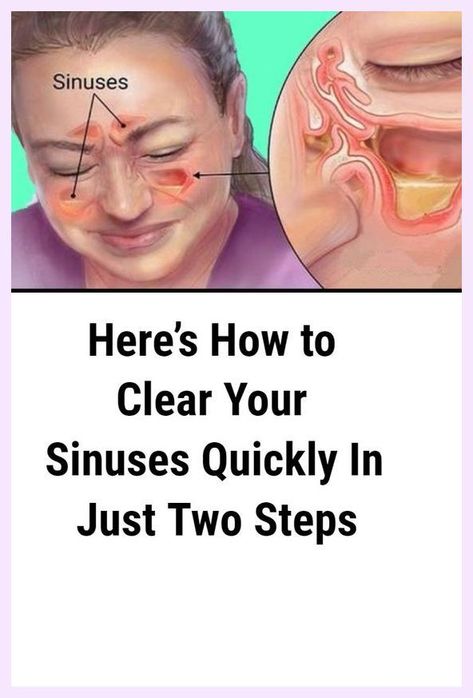Here’s How to Clear Your Sinuses Quickly In Just Two Steps Health, Mom, Happy, Happy Mom, Health Benefits, Tea Health Benefits
