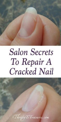Nail Repair, Nail Care Tips, Cracked Nails, Nail Tech, How To Grow Nails, Nail Tips, Nails At Home, Whitening, Hair And Nails