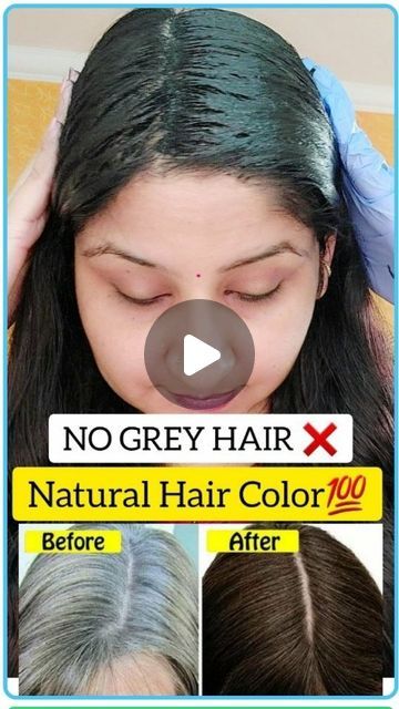 New Hair, Hair Growth, Hair Treatments, Hair Remedies, New Hair Growth, Grey Hair Remedies, Homemade Hair Treatments, Homemade Hair, Remedy For White Hair