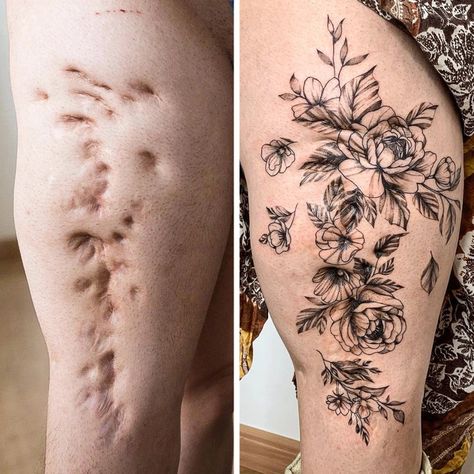 15 Scars That Were Turned Into Works of Art and Are Worthy of Being Shown Off / Now I've Seen Everything Leg Tattoos, Tattoos, Tattoo Designs, Arm Tattoos, Tattoo, Tattoo Artists, Scar Tattoo, Arm Tattoo, Body Tattoos