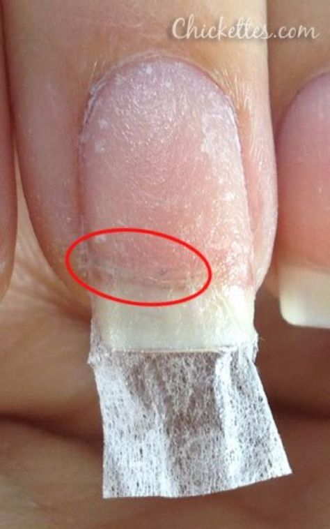 Nail Art Designs, Pedicure, Nail Designs, Nail Repair, Nail Tips, Pedicure Nails, How To Do Nails, Glue On Nails, Manicure And Pedicure