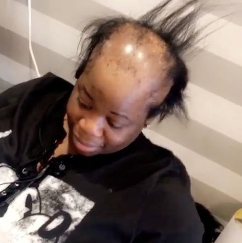 A woman with alopecia went to a salon in Brooklyn, New York, to get her hair done and left with the most amazing makeover. See it here! York, Hair Loss, Hair Growth, Hair Loss Women, Reverse Hair Loss, Hair Regrowth, Alopecia Hair Growth, Extreme Hair, Black Hair Growth