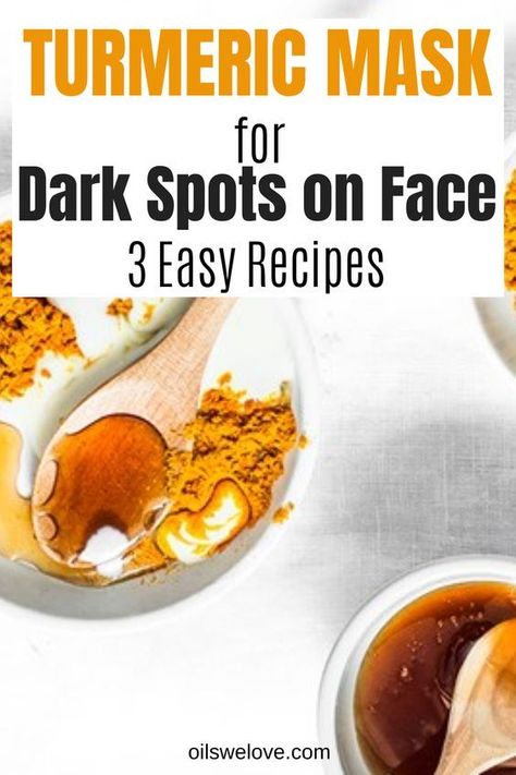 Home Remedies for Pigmentation: How To Reduce Dark Spots Turmeric On Face, Dark Marks On Face, Turmeric For Face, Tumeric Masks, Turmeric For Skin, Dark Spot Remover For Face, Turmeric Facial, Diy Turmeric Face Mask, Dark Spots Remedies
