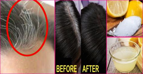 One of the most vexing outcomes of modern lifestyle is white hair. Keep reading this post to know the causes of white hair and tips to prevent white hair.. Prevent Grey Hair, Causes Of White Hair, Hair Problem, Hair Remedies, Best Hair Oil, Grey Hair Remedies, Grey Hair Problem, Types Of Hair Color, White Hair Treatment