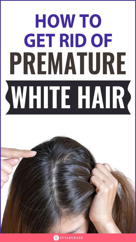 Causes Of White Hair, Stop Hair Loss, Remedy For White Hair, Home Remedies For Hair, Prevent Grey Hair, Stop Grey Hair, How To Darken Hair, Covering Gray Hair, Premature Grey Hair