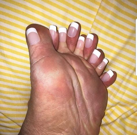 How do you feel about toes though? 24 Photos From The Depths Of The Internet That You'll Never Be Able To Unsee