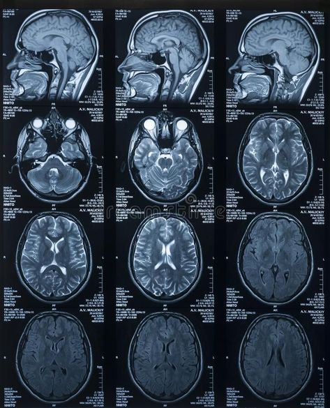 MRI scan of the brain. Medicine and Health. §ð Vertical photo #Sponsored , #sponsored, #… | Medical student motivation, Medical school motivation, Medical wallpaper