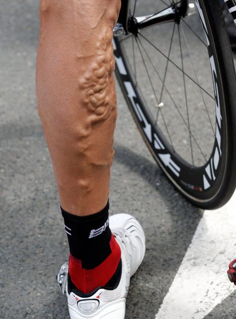Legs, Tour De France, Cycling, Tours, Bmx, Cargo Bike, Classic Bikes, Cyclist, Cycling Bicycles