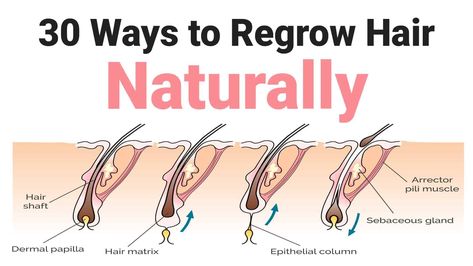 Hair Growth, Hair Loss, Prevent Hair Loss, Regrow Hair Naturally, Hair Regrowth Treatments, Hair Loss Remedies, Regrow Hair, Hair Regrowth, Natural Hair Regrowth