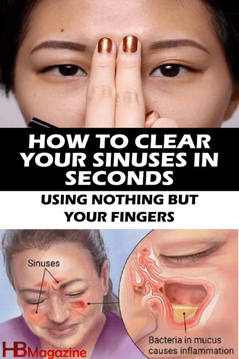 How To Drain Your Sinuses : A Complete Guide How To Clear Sinuses, Sinus Congestion Relief, Remedy For Sinus Congestion, Home Remedies For Sinus, Congestion Relief, Sinus Congestion, Sinus Blockage, Blocked Sinuses, Sinus Infection
