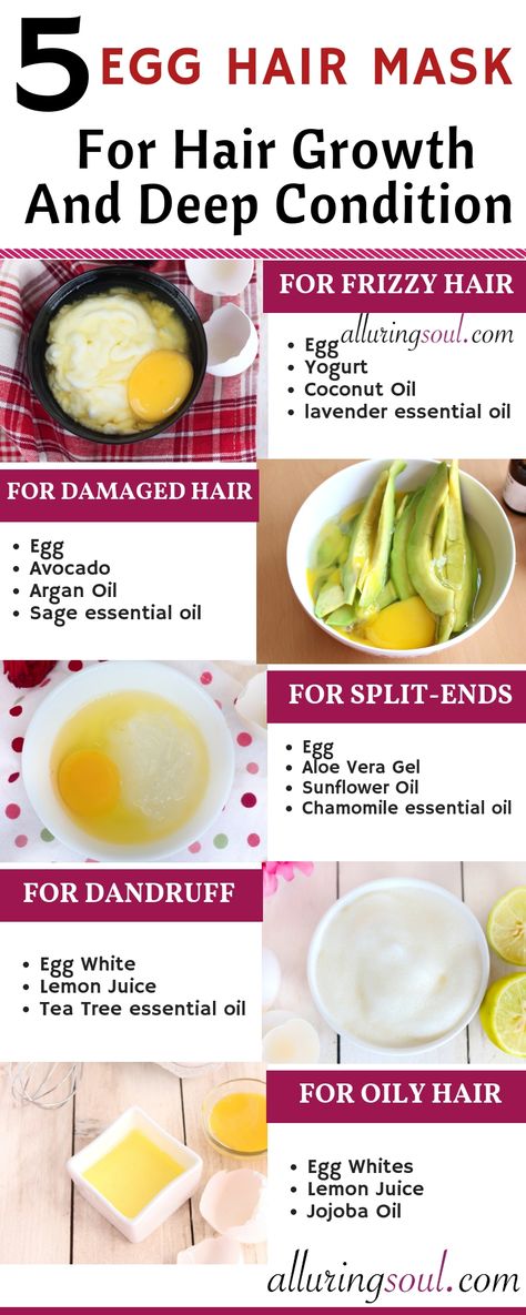 Egg is the boon for dry, frizzy and damaged hair. Eggs can make your hair soft, shiny and manageable and also helps in hair growth. Hair Growth, Egg Hair Mask, Egg For Hair, Hair Mask For Damaged Hair, Home Remedies For Hair, Hair Loss Remedies, Oily Hair, Oils For Dandruff, Hair Remedies