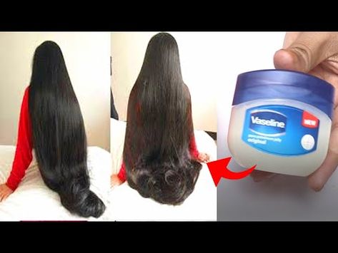 Diy, Videos, Hair Growth Shampoo, Help Hair Grow, Hair Growth Oil, Quick Hair Growth Remedies, Best Hair Loss Treatment, Hair Growth Treatment, For Hair Growth