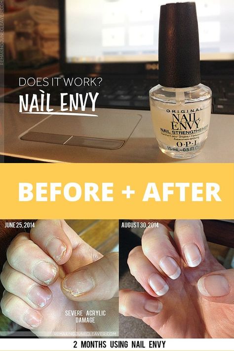Pedicure, Nail Strengthener, Nail Repair, Nail Growth Tips, Dry Nails Quick, Nail Health, Nail Hardener, Opi Nail Envy, Nail Growth