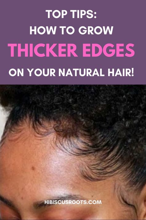 Read this article for top tips on how to regrow thinning edges back fast! How to care for your edges and hairline. How to grow your edges thinner. and how to get thicker, fuller edges and baby hairs on your natural hair! All while using natural and ayurvedic methods! #edges #babyhair #sleekedges #edgeshairstyles Hair Growth Tips, Growing Edges Back, Hair Growth Diy, Natural Hair Growth Tips, How To Get Thick, Thinning Edges, Stimulate Hair Growth, Thicker Stronger Hair, Natural Hair Growth