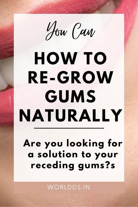 If you are wondering how to re-grow your gums, the first step is identifying the underlying cause. The primary cause of receding gums is the aging process. Repetitive exposure to bacteria and plaque causes damage to the alveolar bone and soft tissue. ... less Receding Gums, Aging Process, Tooth Decay, Oral Care, Cavities, First Step, Gum