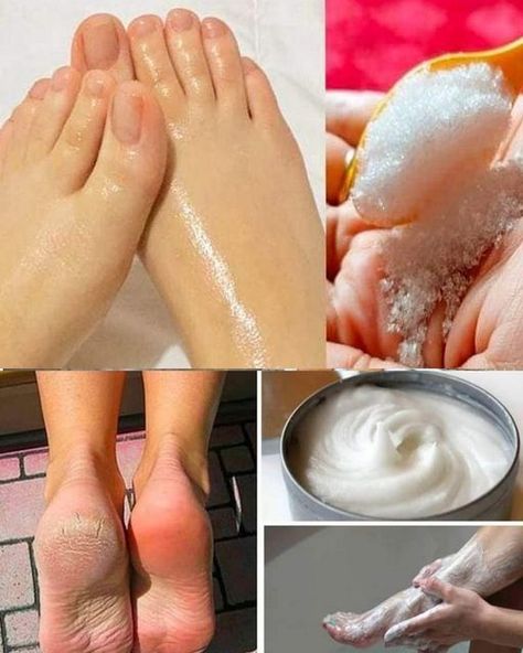 Here’s how to do a pedicure at home with baking soda Pedicure, Pop, Uñas, Homemade, How To Do Pedicure, Pedicure At Home, Feet Care, Soda, Remedies