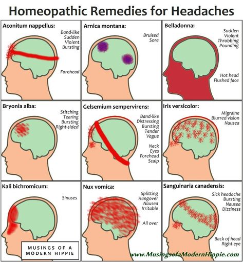 Homeopathy for Headaches Natural Headache Remedies, Headache Remedies, Migraine Relief, Headache Types, Sinus Headache, Migraine Headaches, Homeopathic Remedies, Headache Relief, Natural Headache