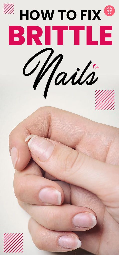 How To Fix Brittle Nails : it’s important to understand that sometimes brittle nails aren’t just something silly, it could be a sign of something serious too.From the minor to the most serious clues that nails give with regards to your body health, take a look below! #nailcare #brittlenails #nails Brittle Fingernails, Stop Hair Loss, Brittle, Brittle Nails, Fingernail Health Signs, Oil For Hair Loss, Hair Loss Shampoo, Nail Health Signs, Nail Strengthener