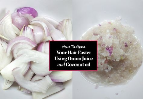 How To Grow Your Hair Faster Using Onion Juice and Coconut Oil Coconut Oil, Diy, Ankara, Life Hacks, Onion Oil For Hair, How To Grow Your Hair Faster, Thinning Hair Remedies, Hair Health, Hair Regrowth