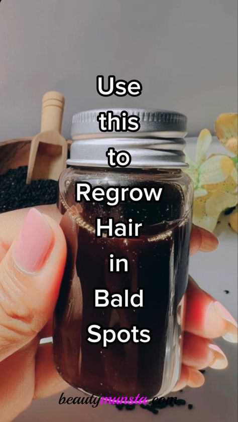 Use this remedy to regrow hair in bald spots. This DIY black seed hair growth oil is one thing you need to try before you give up on natural remedies for hair growth. Hair Growth Oil Recipe, Hair Growth Tonic, Homemade Hair Treatments, Healthy Natural Hair Growth, Herbs For Hair, Hair Growing Tips, Hair Growth Diy, Hair Remedies For Growth, Regrow Hair