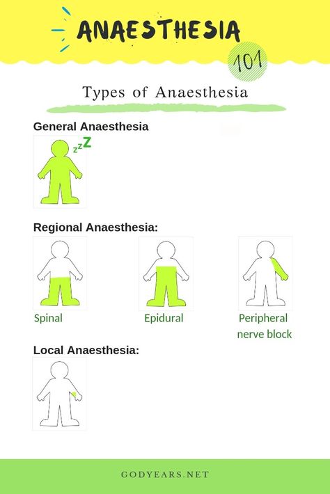 How many types of Anaesthesia do you know of? Anesthesia, Medical Facts, Pharmacology Nursing, Medical Surgical Nursing, Anesthesia School, Medical Knowledge, Anesthesiology, Medical Studies, Medical Education