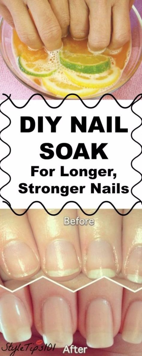 Shellac, Nail Soak, Nail Growth, Stronger Nails, Nail Tips, Healthy Nails, Nail Art Diy, Nail Nail, Natural Nails