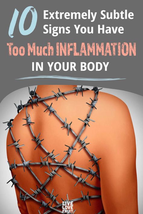 human body wrapped in barbed wire to demonstrate the pain of chronic inflammation with text - 10 extremely subtle signs your have too much inflammation in your body Health, Body, Extreme, Subtle, Wellness, Health And Wellness, Live Love, 10 Things, Planner
