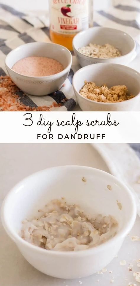 These DIY scalp scrubs can easily be done at home, are cost-effective, and can help with dandruff. Made with nourishing ingredients and essential oils that can strengthen hair, these scalp scrubs will keep your hair and scalp healthy. #scalpscrubs #dandruff #naturalhaircare Fitness, Bath, Ideas, Scrubs, Dry Scalp Treatment Diy, Dry Scalp Treatment, Dandruff Home Remedies, Diy Hair Mask For Dandruff, Home Remedies For Dandruff