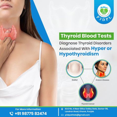 Thyroid Blood Tests Thyroid Cancer, Thyroid Hormone, Thyroid Test, Thyroid Disease, Hypothyroidism, Thyroid Disorders, Hyperthyroidism, Thyroid, Thyroid Awareness