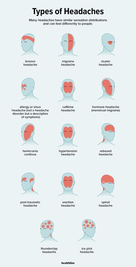 Types of Headaches: Symptoms, Causes, Treatments, and More Useful Life Hacks, Types Of Headaches Chart, Types Of Cancers, Medical Symptoms, Headache Types, Sinus Headache Symptoms, Tension Headache Symptoms, Types Of Diseases, Headache Type