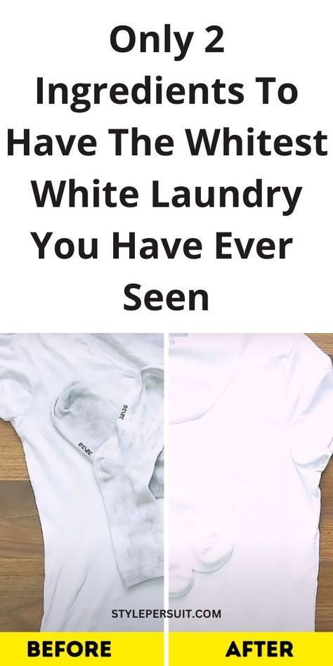 Is one of you clothings loosing its bright white? Its time to give it life again. Use these super simple methods to whiten white clothes naturally White, Body Hair Removal, White Clothes Washing, Clothes Washing Hacks, Washing Clothes, How To Whiten Clothes, Whiten White Clothes, Unwanted Hair Removal, Washing White Clothes