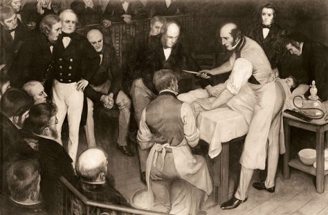A painting depicting one of the first British operations carried out with anaesthesia by pioneering Scottish surgeon Robert Liston. He operated with a knife gripped between his teeth, and could amputate a leg in under three minutes. Horror, Opera, Surgery, Historia, Surgeon, Vintage Medical, Medical, Anesthesia, Doctor