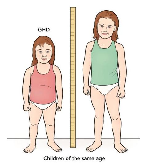 Growth Hormone Deficiency in Children Health, Growth Hormone, Hormone Health, Hormones, Symptoms, Growth Factor, Pituitary Gland, Failure To Thrive, Growth