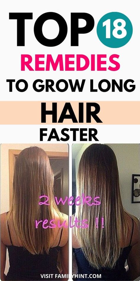 Bari, Popular, How To Grow Hair Faster, How To Grow Your Hair Faster, Fast Hair Growth, Faster Hair Growth, Hair Growth Faster, Regrow Hair Naturally, Ways To Grow Hair