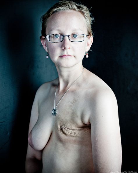 Portrait, People, Mastectomy, Breast Cancer Survivor, Body Image, Breast Cancer Awareness, Breast Cancer, Breast, Fight Like A Girl