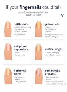 Often, our hair, skin, and nails reflect our interior health. Here are six common fingernail issues—and what they’re trying to tell you about your health. Ongles, Fingernails, Natural Nails, Fun Nails, Haar, Nail Colors, Strong Nails, Nail Growth, Healthy Nails
