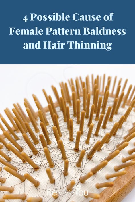 While many cases come from genetics, this isn’t the only reason women might experience thinning hair. Here are a few risk factors that could cause hair loss. Hair Loss, Hair Loss Women, Hair Shedding Remedies, Hair Loss Remedies, Hair Loss Natural Remedy, Stop Hair Loss, Thinning Hair, Hair Health, Home Remedies For Hair