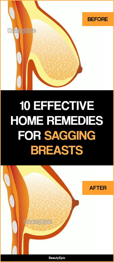 Natural Remedies, Natural Home Remedies, Fitness, Home Remedies For Hemorrhoids, Breast Enhancement, Breast Health, Remedies, Health Remedies, Home Health Remedies
