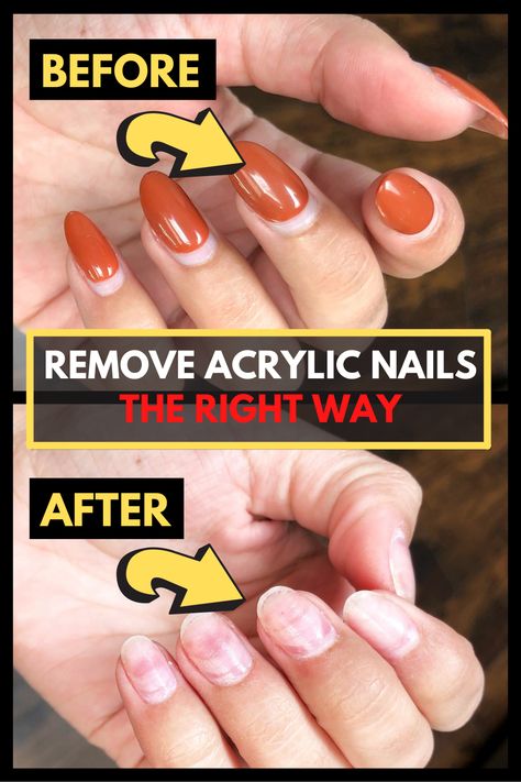 Pedicure, Inspiration, Design, Remove Gel Nails, Removing Gel Nails, Removing Acrylic Nails, Soak Off Acrylic Nails, Remove Acrylics, How To Gel Nails